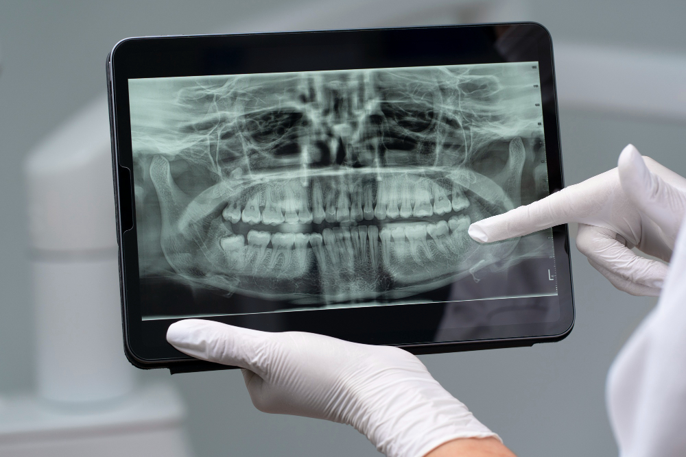 Digital X-Rays  Dayton, NV
